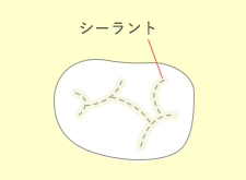 シーラント